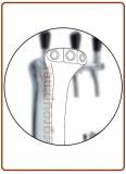 Ice ricambio colonnina meccanica 1, 2, 3 vie Cromata, Dorata